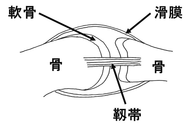 関節リウマチ